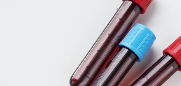 دليل شامل: لماذا لون الدم أحمر؟