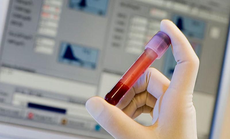 زراعة الخلايا الجذعية في الإمارات: أمل جديد للمرضى