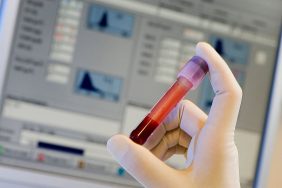 الخلايا الجذعية: منقذ محتمل للعائلات التي تعاني من الأمراض الوراثية