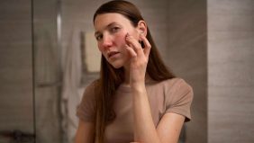 جفاف الجلد في الشتاء: مشاكل وحلول من أطباء الجلدية