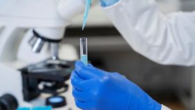 اللاصقة الذكية للكشف المبكر عن سرطان الجلد: حل غير جراحي وفعال