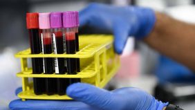 فصيلة الدم A: هل هي علامة تحذير لسرطان الثدي؟