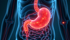 GRAPE: بصيص أمل في الكشف المبكر لسرطان المعدة في آسيا