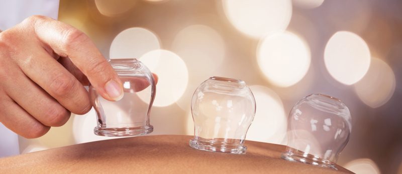 اكتشف مراكز الحجامة في الشارقة وأثرها على صحتك