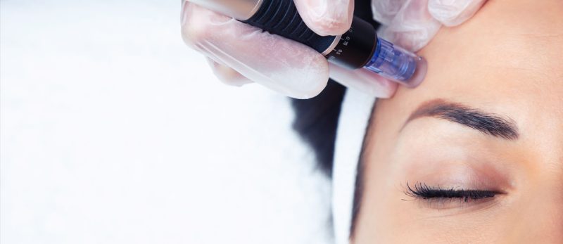 عيادات التجميل في العين: من العلاجات التقليدية إلى الحديثة