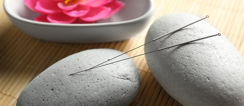 اكتشف قوة العلاج بالإبر الصينية في دبي لتحسين صحتك