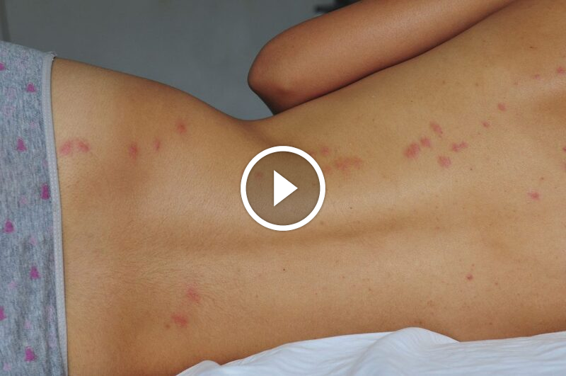 جودة لا تُضاهى مع ضمان مكافحة الآفات الفعال