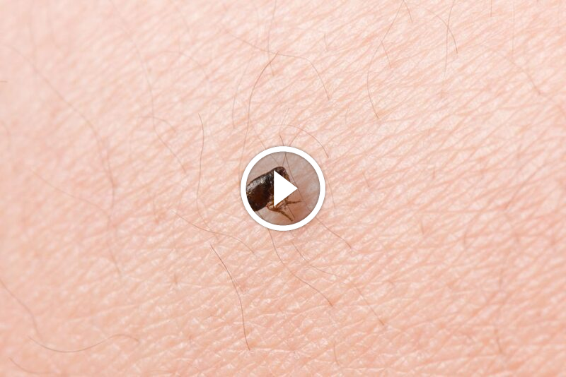 فهم فعالية الديتول ضد البراغيث للحفاظ على منزل نظيف