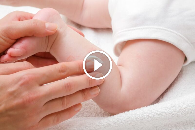 تخفيف الألم والحكة: أسرع علاجات لدغات البق للأطفال