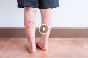 ضمان استرداد الأموال: فلسفة عمل تضع العميل أولاً